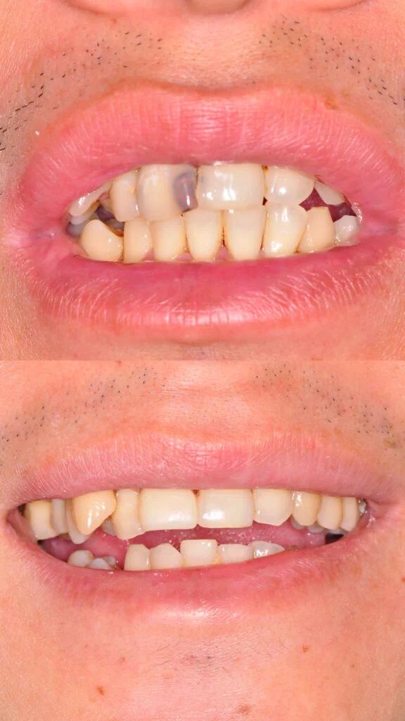 teeth scaling damansara heights