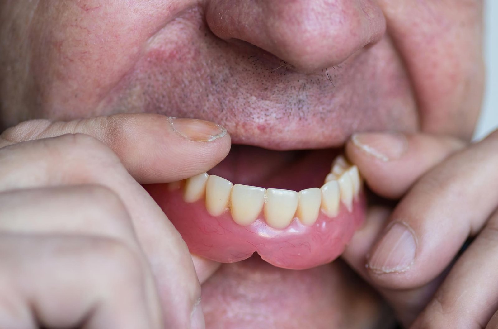 You are tired of a loose or uncomfortable denture