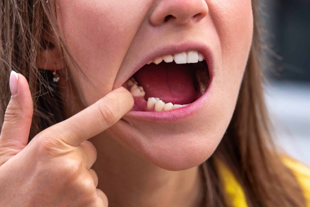 missing a tooth